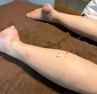 たくみ鍼灸整体所属・後藤 巧のエステ・リラクイメージ