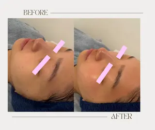 艶肌ワックス ALLY.のエステ・リラクイメージ