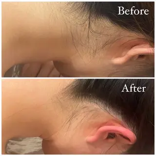 Tulipe Chihoのエステ・リラクイメージ