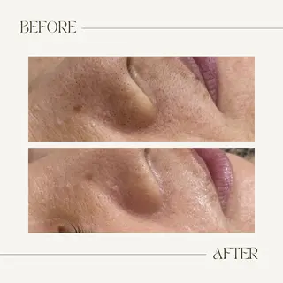 CEsalonEgg 齋藤のエステ・リラクイメージ