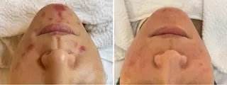 肌質改善 KALANCHOEのエステ・リラクイメージ
