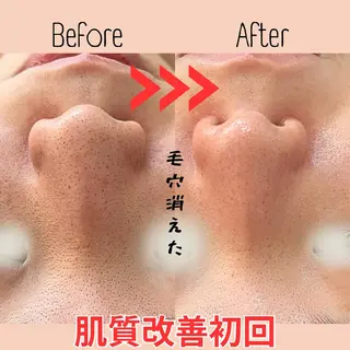 小顔コルギ&肌質改善 の専門店LIBREのエステ・リラクイメージ