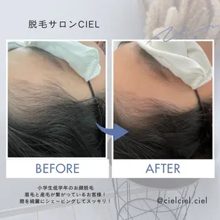 キッズ 脱毛サロン CIELのエステ・リラクイメージ