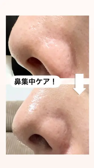 W MISATOのエステ・リラクイメージ