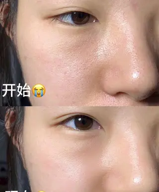 ネイル 愛維美水光美肌専門店所属・愛維美水光美肌専門店 メンズレディースokのエステ・リラクイメージ