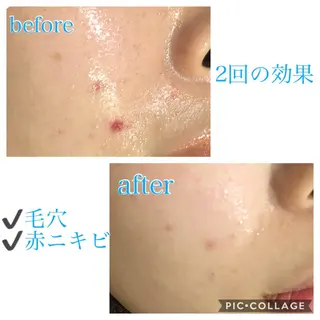 ロング カラー パーマ ヘアアレンジ キッズ ネイル マツエク・マツパ EnsorClair 代表 野口真央のエステ・リラクイメージ