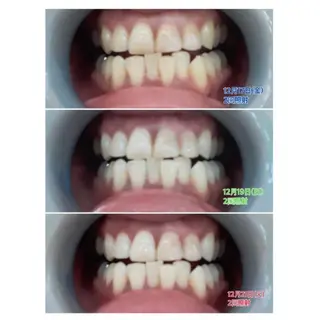 Ｍ渋谷 ホワイトニングのエステ・リラクイメージ