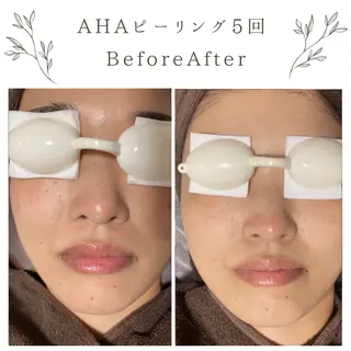 な ぎのエステ・リラクイメージ