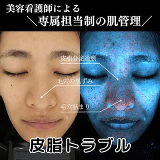 美容看護師専属担当制 医学に基づく肌管理のエステ・リラクイメージ