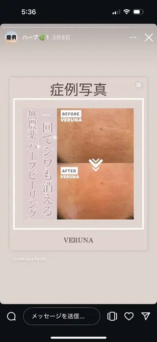 ハーブピーリング専門 グランディール　武内のエステ・リラクイメージ