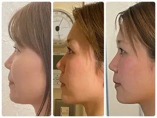 NICOLI 岩崎雅恵／日本大通りのエステ・リラクイメージ