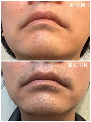 Re-PEP 大城のヘアスタイル