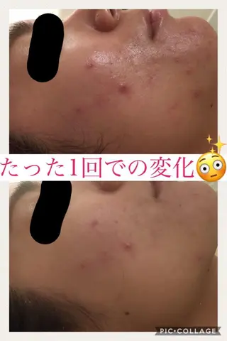 ミディアム カラー パーマ ヘアアレンジ メンズ キッズ ネイル マツエク・マツパ ニキビ・肌質改善専門 ♡人生が変わるサロンのエステ・リラクイメージ