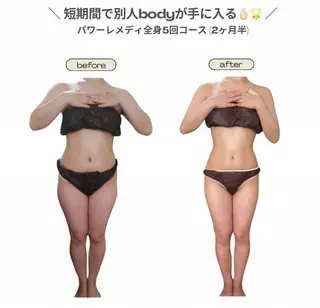 《本気痩せ×疲労改善 》  BILOOPのエステ・リラクイメージ