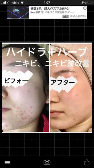 セミロング カラー パーマ ヘアアレンジ メンズ キッズ ネイル マツエク・マツパ アイブロウ ハーブピーリング専門 🌿モッカのエステ・リラクイメージ