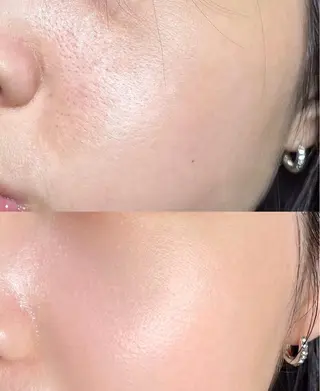 愛維美水光美肌専門店所属・愛維美水光美肌専門店 メンズレディースokのエステ・リラクイメージ