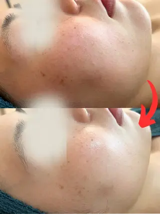 小顔コルギ&肌質改善 の専門店LIBREのエステ・リラクイメージ