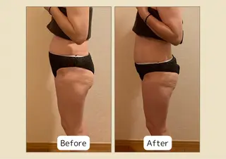 温活痩身専門店 ヨサパークミリューのエステ・リラクイメージ