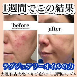 salon  mebell所属・肌管理専門店 mebell天王寺店のエステ・リラクイメージ