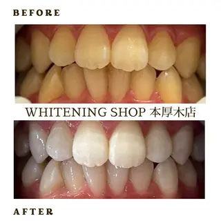 メンズ ホワイトニング ショップ本厚木のその他イメージ