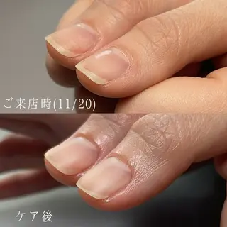 ネイル Aim* 深爪自爪育成専門店のネイルデザイン