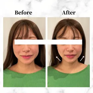 12Dハイフ💗 最強小顔のエステ・リラクイメージ
