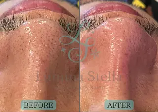 VIO脱毛＆SPA ルミナステラのエステ・リラクイメージ