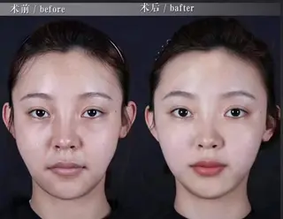 マツエク・マツパ aliaハーブ水光店 エステティシャン募集のエステ・リラクイメージ