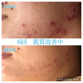 ロング カラー パーマ ヘアアレンジ メンズ キッズ ネイル マツエク・マツパ EnsorClair 代表　野口真央のエステ・リラクイメージ