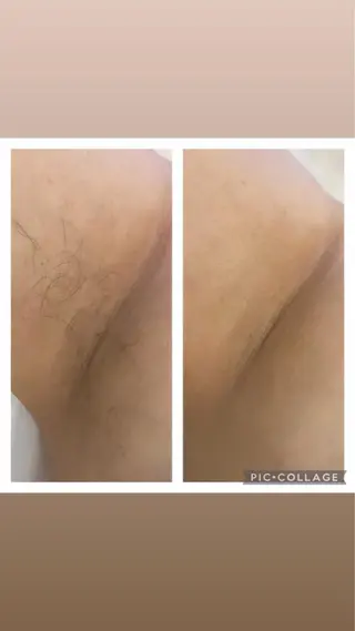 MARI シュガーリストのエステ・リラクイメージ