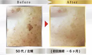 毛穴シミケアサロン Beau　堀口まひろのその他イメージ