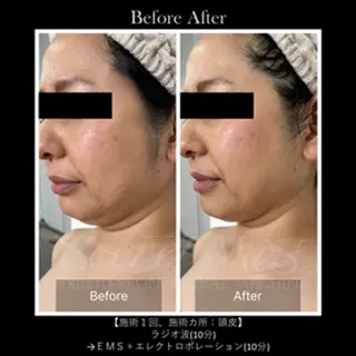 伊藤 正美のマツエク・マツパデザイン