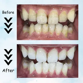 メンズ セルフホワイトニング エクシア塩釜口駅前店所属・セルフホワイトニング エクシア塩釜口駅前店のその他イメージ