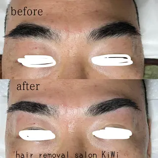 アイブロウ 脱毛サロン KiWiのエステ・リラクイメージ