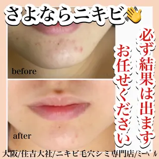 salon  mebell所属・肌管理専門店 mebell天王寺店のエステ・リラクイメージ