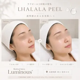 【医療提携エステ】 ルミナス北浦和のエステ・リラクイメージ