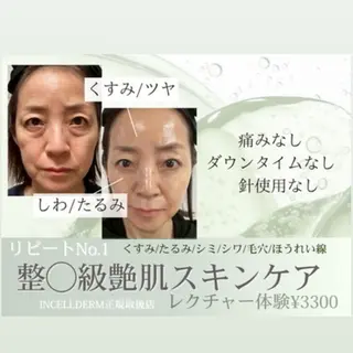 【vidyto】ヴィディトゥ所属・肌管理サロン vidyto　MOEのエステ・リラクイメージ