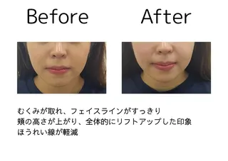 鍼灸師 NARUMIのエステ・リラクイメージ