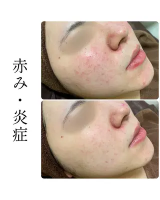 ハーブピーリング専門 BIOEL横浜のエステ・リラクイメージ