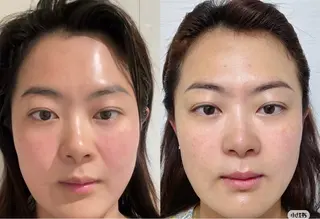 マツエク・マツパ aliaハーブ水光店 エステティシャン募集のエステ・リラクイメージ