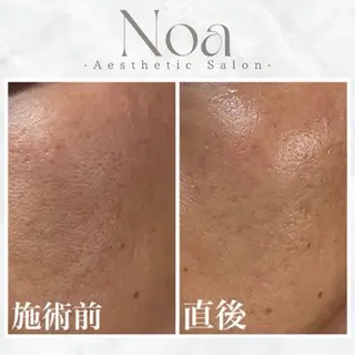 肌質改善サロン Noaのエステ・リラクイメージ