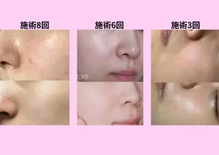 マツエク・マツパ 愛維美水光美肌専門店 メンズレディースokのエステ・リラクイメージ