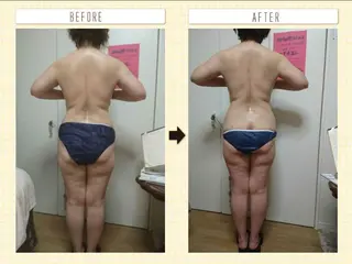 Arebeau 健康的にダイエットのエステ・リラクイメージ