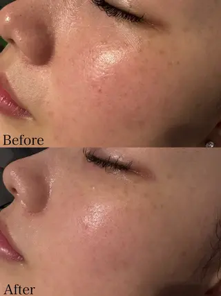 beautysalon LIMOA所属・松本 愛絵理のエステ・リラクイメージ