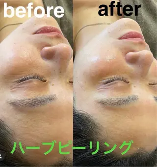 鍼灸サロン mahorobaトモのエステ・リラクイメージ