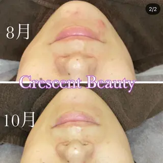 crescent 福寿のマツエク・マツパデザイン