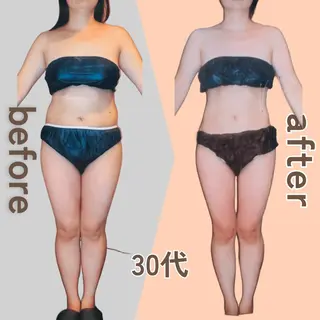 痩身エステ Julien麹町店のエステ・リラクイメージ