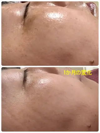 Lien オーナー　山口智嘉のエステ・リラクイメージ