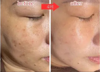 肌管理&nail Salon  Duxのエステ・リラクイメージ