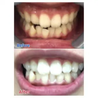 Ｍ渋谷 ホワイトニングのエステ・リラクイメージ